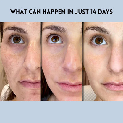 Virella™ — Instantly Lift, Hydrate, and Radiate Youthful Confidence
