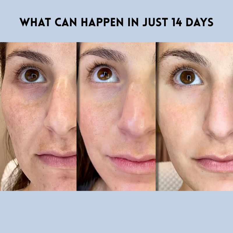 LumaLift™ Strips — Instantly Smooth, Lift, and Glow Like You’ve Turned Back the Clock