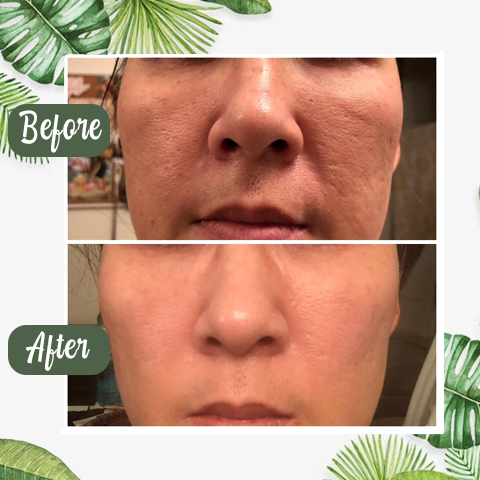 Virella™ Detox Mask Stick — Unlock Radiant, Shine-Free Skin That Commands Attention