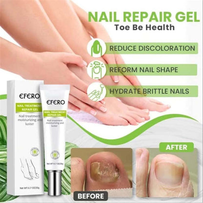 VitaShield™ Nail Renew Gel — Unlock Bold, Beautiful Nails That Command Attention