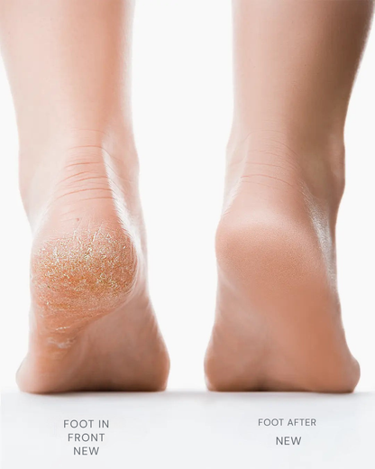 GlideLuxe™ — Instantly Reveal Silky, Show-Off Feet Without Pain or Fuss