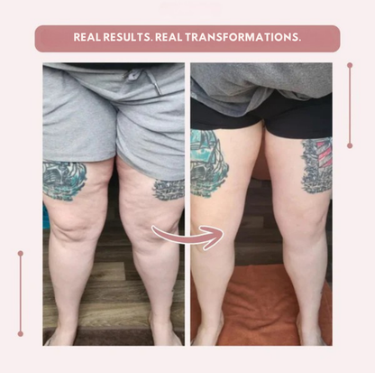 VeinVive™ — Energize Your Legs with All-Day Comfort and Confidence