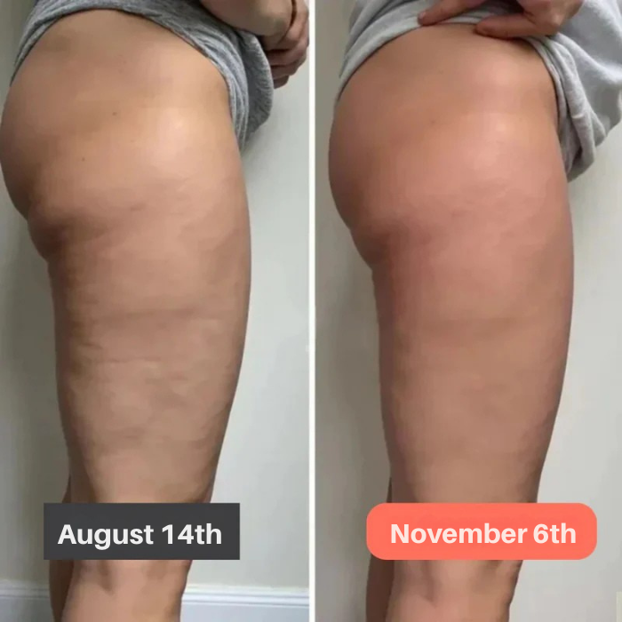 VeloSculpt™ Leggings — Sculpt Your Strongest, Smoothest Legs and Own Every Step