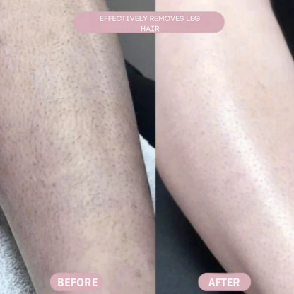 SilkenEdge™ — Glide Into Pain-Free, Baby-Soft Skin You’ll Love to Show Off