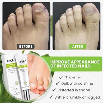 VitaShield™ Nail Renew Gel — Unlock Bold, Beautiful Nails That Command Attention
