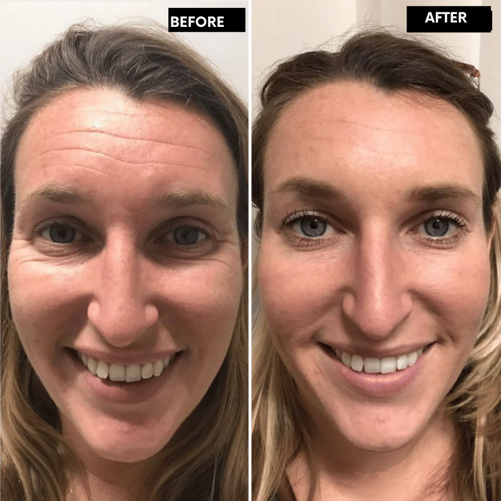 RadianceRush™ Retinal Serum — Unleash Silky, Youthful Skin That Commands Attention