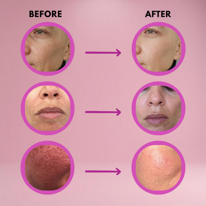 VeloraMist™ — Instantly Smooth Wrinkles and Unleash a Youthful Radiance