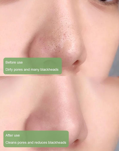 Virella™ Detox Mask Stick — Unlock Radiant, Shine-Free Skin That Commands Attention