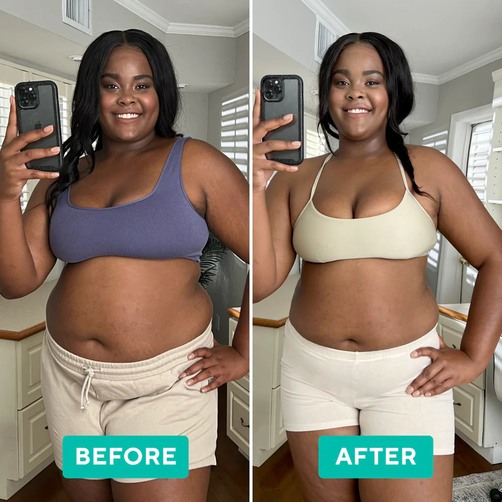 Sculptara™ — Melt Fat and Reveal Radiant Skin Without Sweat or Struggle