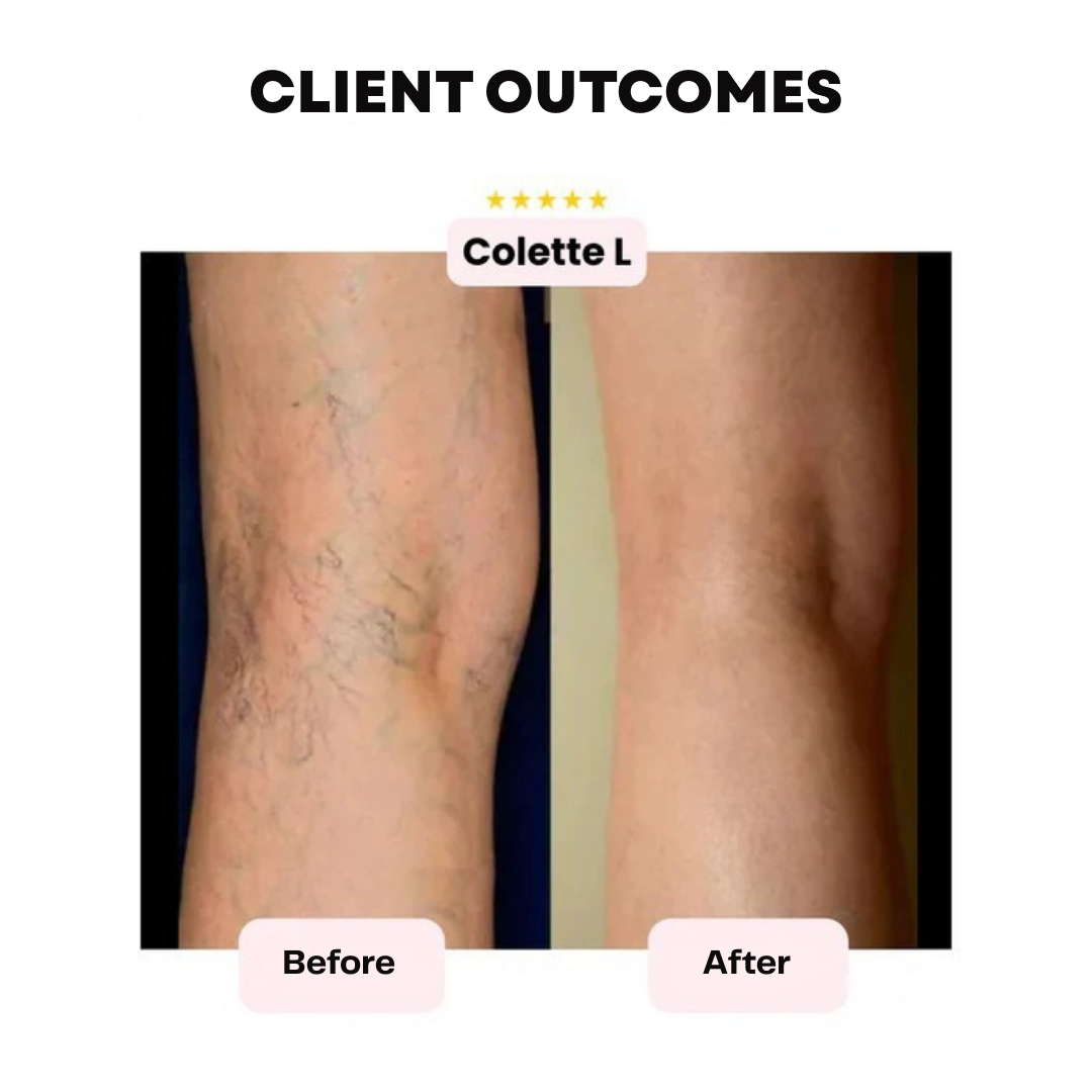 LuminaSkin™ — Own Flawless, Radiant Skin That Never Quits