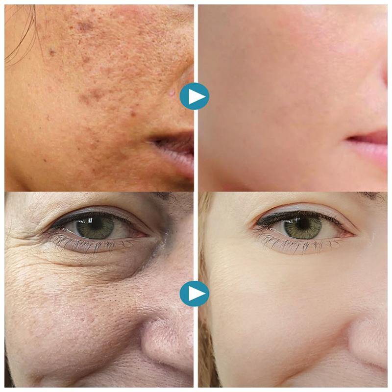 Velissea™ Blur Balm — Unlock Silky, Poreless Skin That Lasts All Day