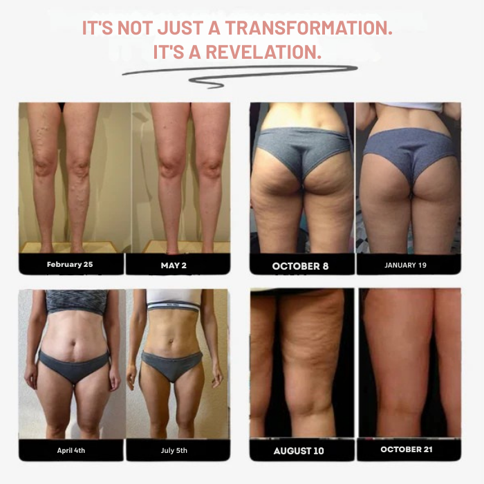 VeloSculpt™ Leggings — Sculpt Your Strongest, Smoothest Legs and Own Every Step