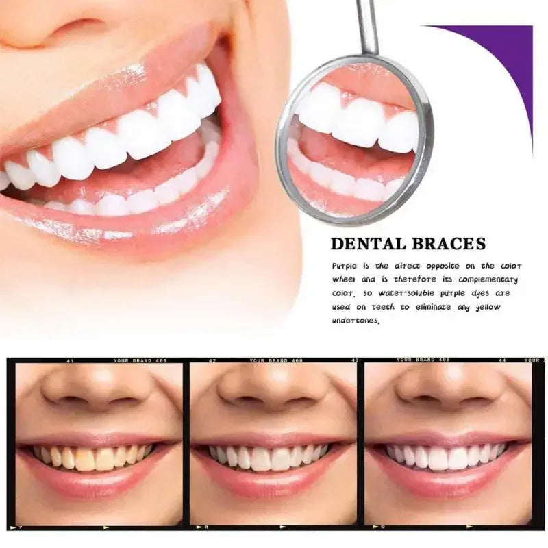 RadiantBeam™ — Instantly Brighten Your Smile Without Pain or Wait