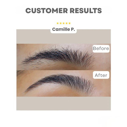 SculptEase™ — Effortless Precision for Perfect, Pain-Free Brows Every Time