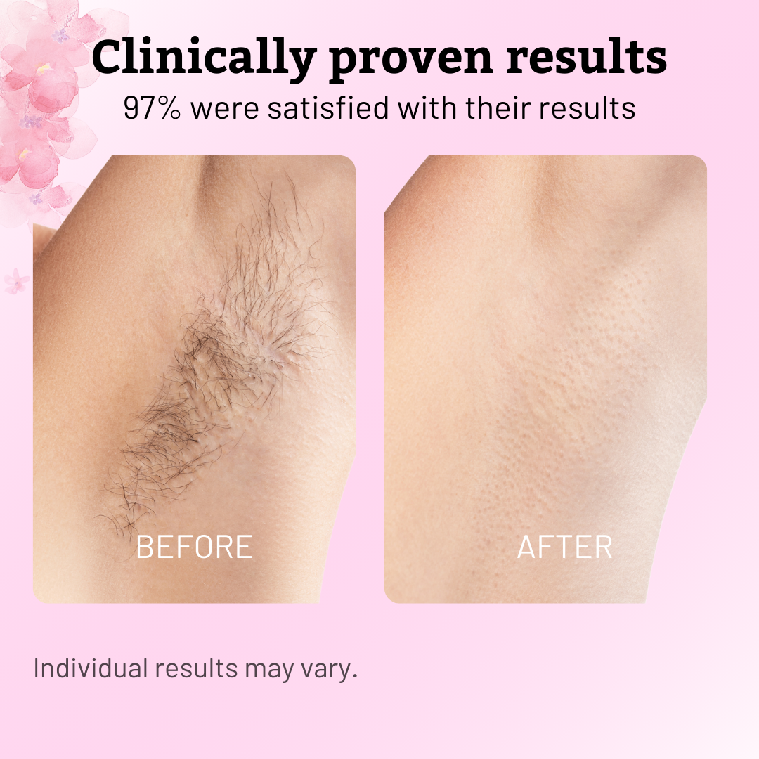 VeluPure™ — Effortless Smooth Skin That Boosts Your Confidence Every Day