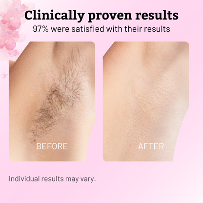 VeluPure™ — Effortless Smooth Skin That Boosts Your Confidence Every Day