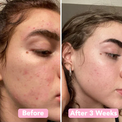 RadiantWink™ Elixir Pads — Wake Up to a Stunning, Spotless Glow That Turns Heads