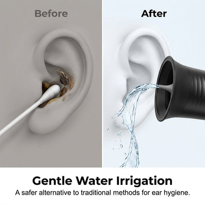 PureLuxe™ — Experience Effortless, Pain-Free Ear Cleaning That Revives Your Confidence
