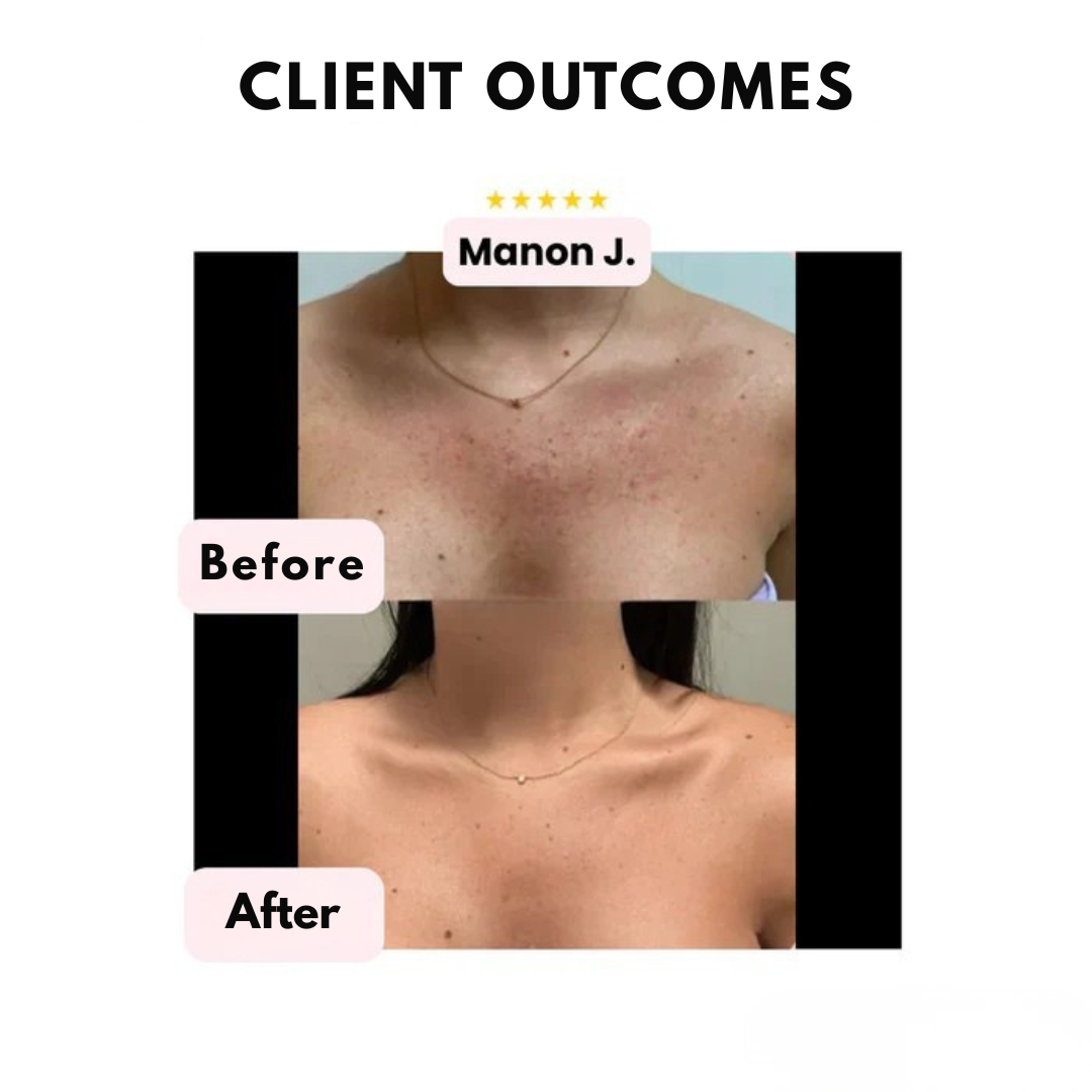 LuminaSkin™ — Own Flawless, Radiant Skin That Never Quits