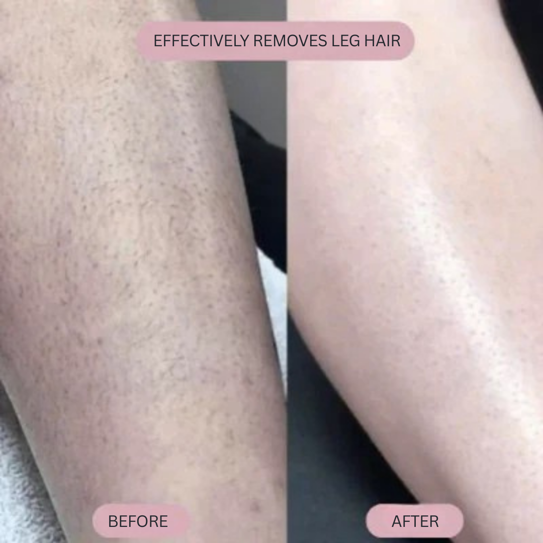 VelvaSmooth™ — Discover Silky, Bump-Free Skin and Unshakable Confidence