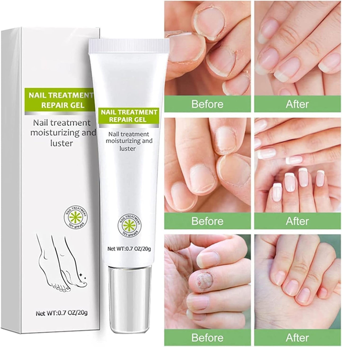 VitaShield™ Nail Renew Gel — Unlock Bold, Beautiful Nails That Command Attention