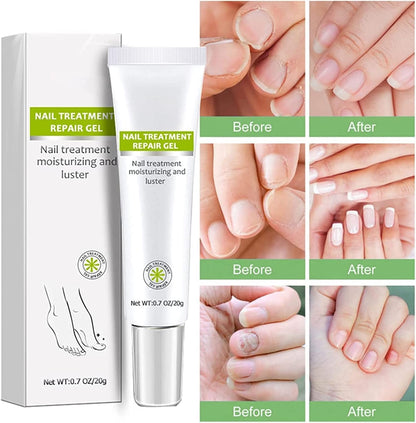 VitaShield™ Nail Renew Gel — Unlock Bold, Beautiful Nails That Command Attention