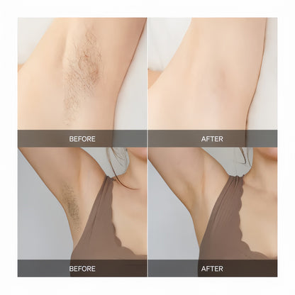 Silkaire™ — Effortless, Pain-Free Smooth Skin That Lasts and Glows