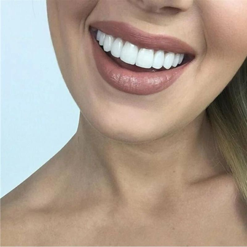 SmileFlex™ — Unleash a Stunning, Effortless Smile That Transforms Your Confidence Instantly