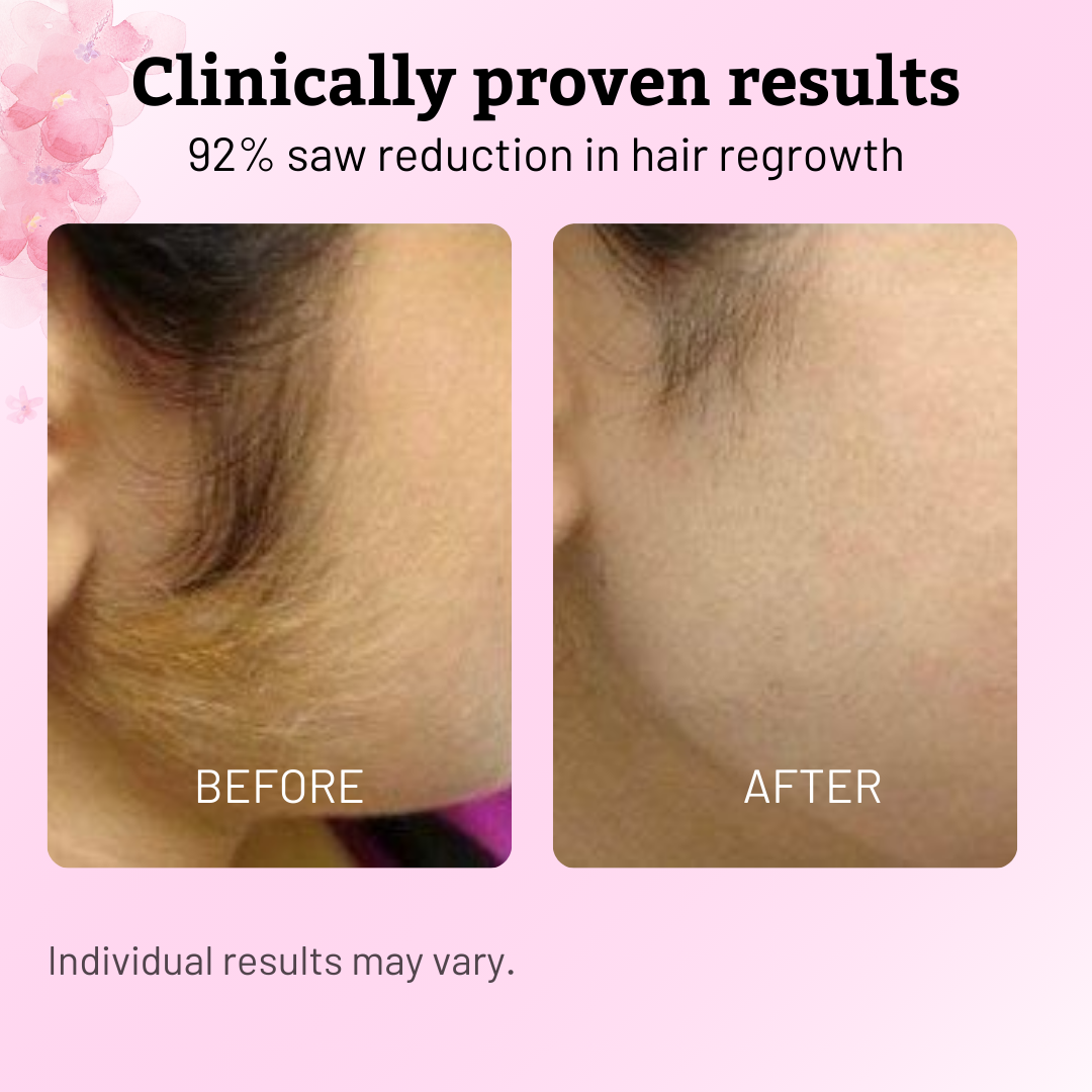 VeluPure™ — Effortless Smooth Skin That Boosts Your Confidence Every Day