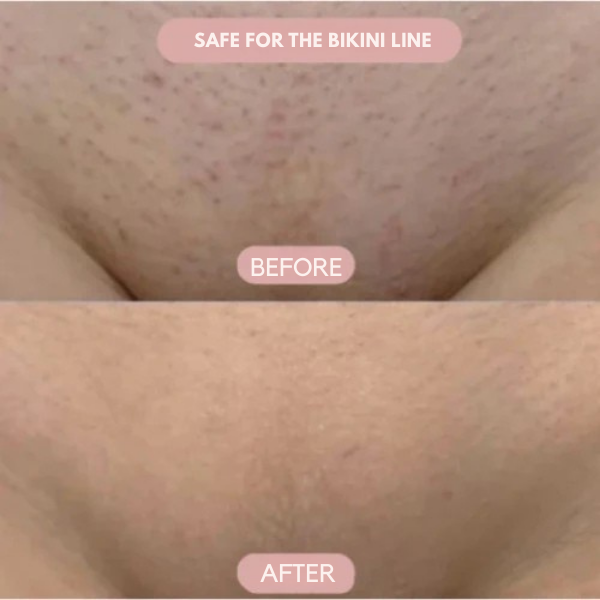SilkenEdge™ — Glide Into Pain-Free, Baby-Soft Skin You’ll Love to Show Off