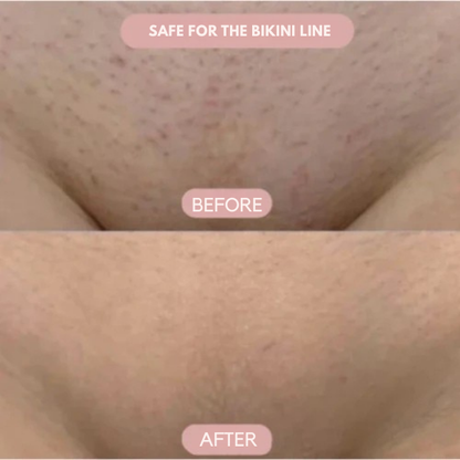 SilkenEdge™ — Glide Into Pain-Free, Baby-Soft Skin You’ll Love to Show Off